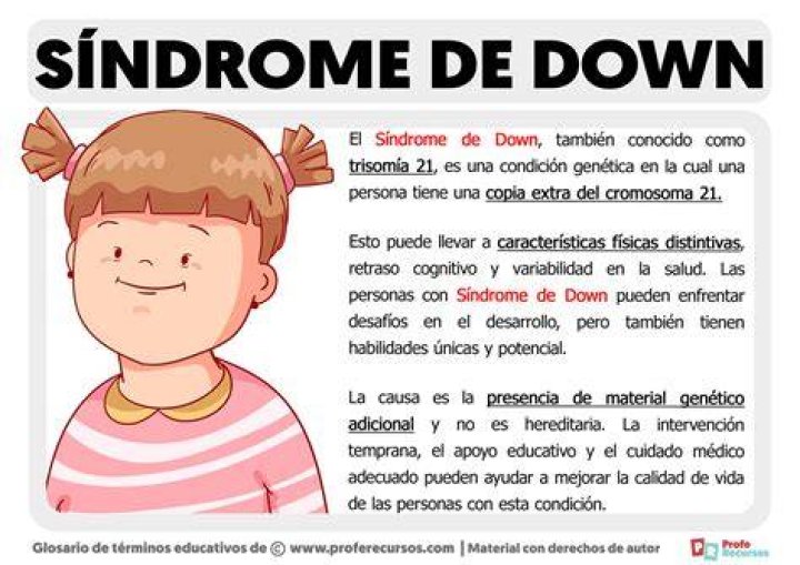 &iquest;Qu&eacute; es el s&iacute;ndrome de Treacher Collins y c&oacute;mo afecta al beb&eacute;? Madres Hoy