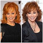 Reba Mcentire Plastic Surgery? See Her Transformation