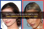 Rumors on Hailey Bieber’s Plastic Surgery — Threatened to Sue a Surgeon