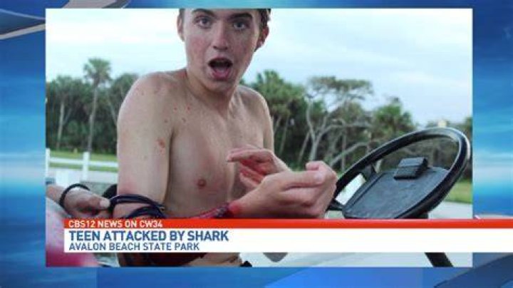 SharkBanz investigates local teen's rare attack wearing shark repelling