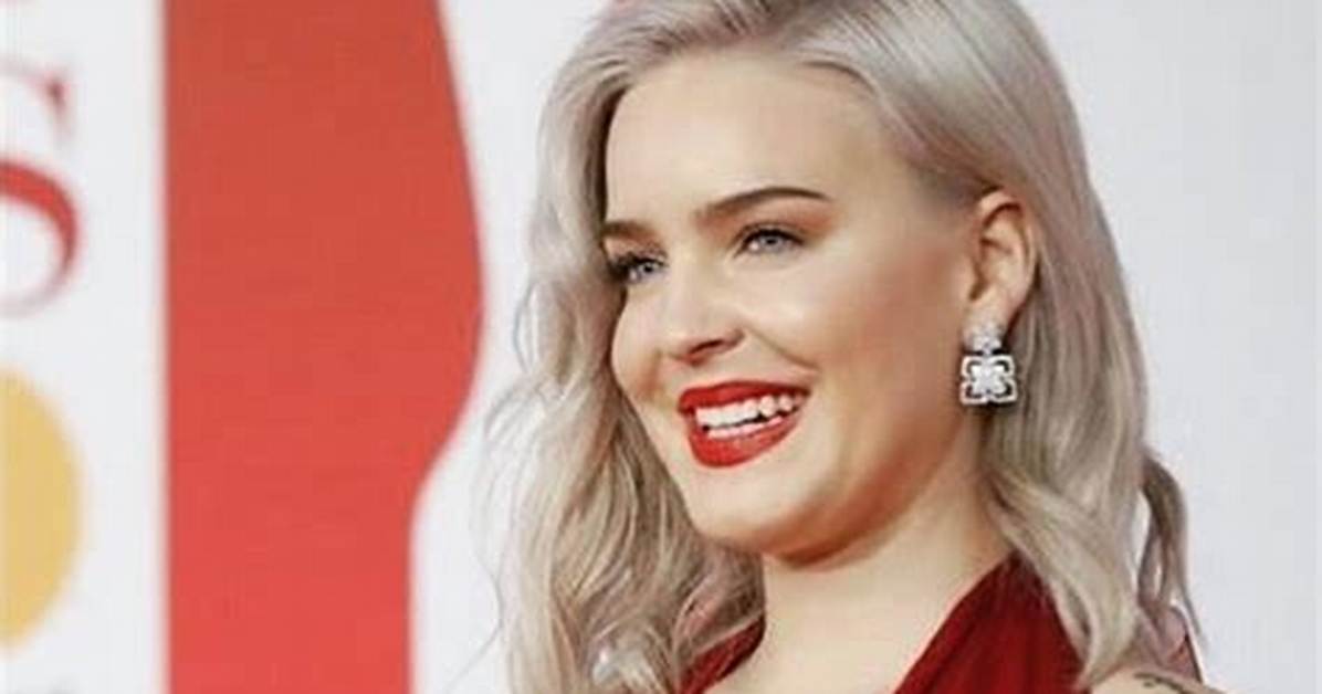 Singer Anne-Marie’s Net Worth Facts | Flying in Private Jets and Luxury Lifestyle