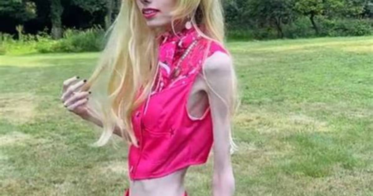 Stacey Q Eating Disorder: Is She Anorexic? Health 2023