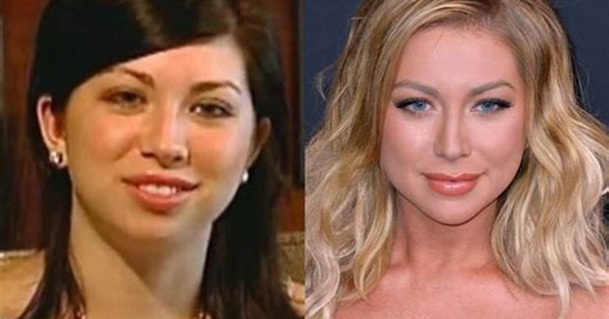 Stassi Schroeder | Plastic Surgery and Breast Reduction Surgery
