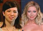 Stassi Schroeder | Plastic Surgery and Breast Reduction Surgery