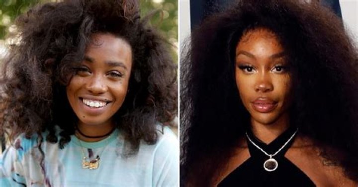 SZA Before Plastic Surgery. Introduction by Surgical Tech Medium