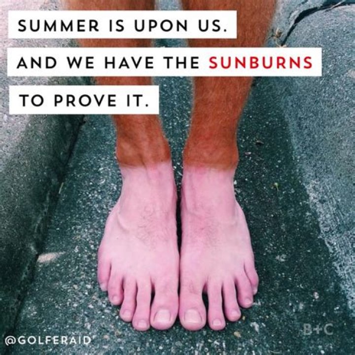 The Best Funny Sunburn Quotes Home, Family, Style and Art Ideas