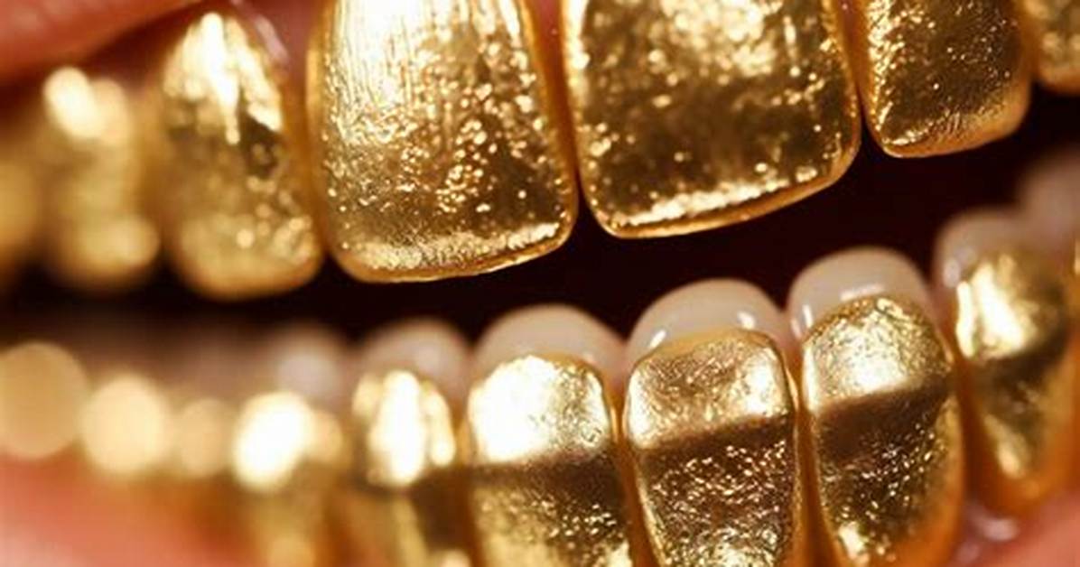 The Golden History of Golden Teeth and Grillz: Adding One More Reason to Smile