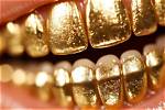 The Golden History of Golden Teeth and Grillz: Adding One More Reason to Smile