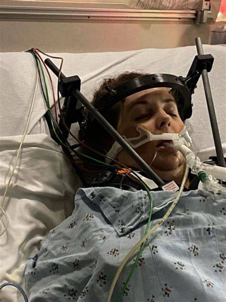 UAB care team leads patient through lifechanging internal decapitation