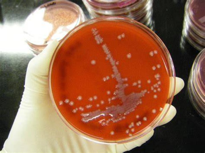 Urine Culture 1 (BAP) this is from someone's pee! poor pat&hellip; Flickr