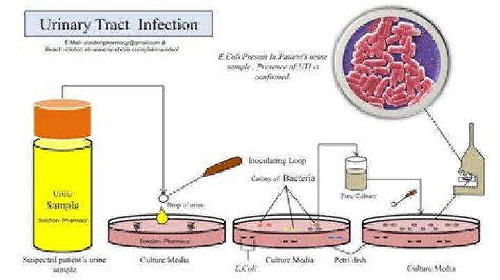 Urine Culture test Price, Purpose, Timing & Report [2024] &bull; Bookmerilab