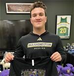 Washington Football Grady Gross Cleft Lip: What Is Wrong with His Face?