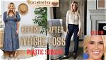 Weight Loss and Plastic Surgery