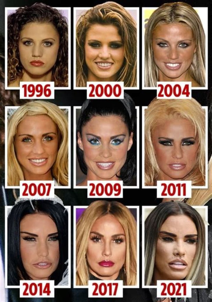 What happened to Katie Price&rsquo;s teeth? Quora