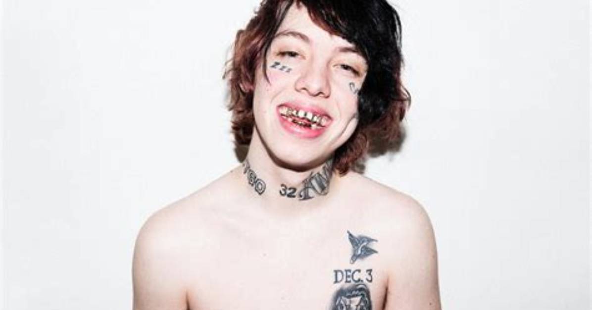 What Happened to Lil Xan Teeth? Before and After Photos