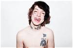 What Happened to Lil Xan Teeth | Before and After Photos