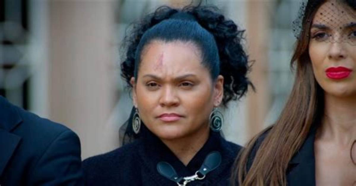 What Happened to Sandra's Forehead?