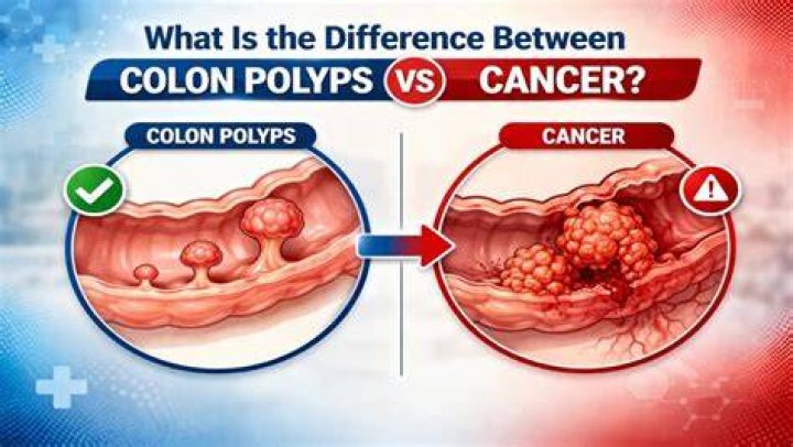 What is difference between polyps and medusae? Brainly.in