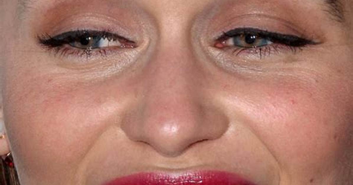 What Is Wrong with Emilia Clarke Teeth: Before and After