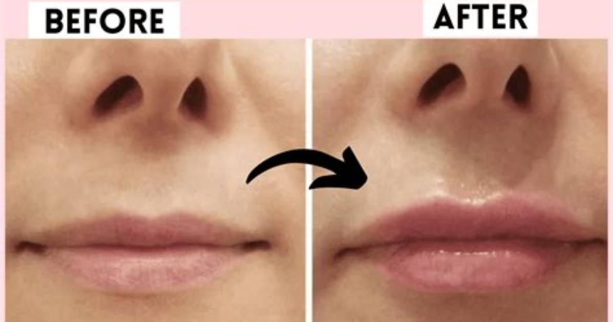 What Is Wrong with Her Lips?