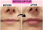 What Is Wrong with Her Lips?