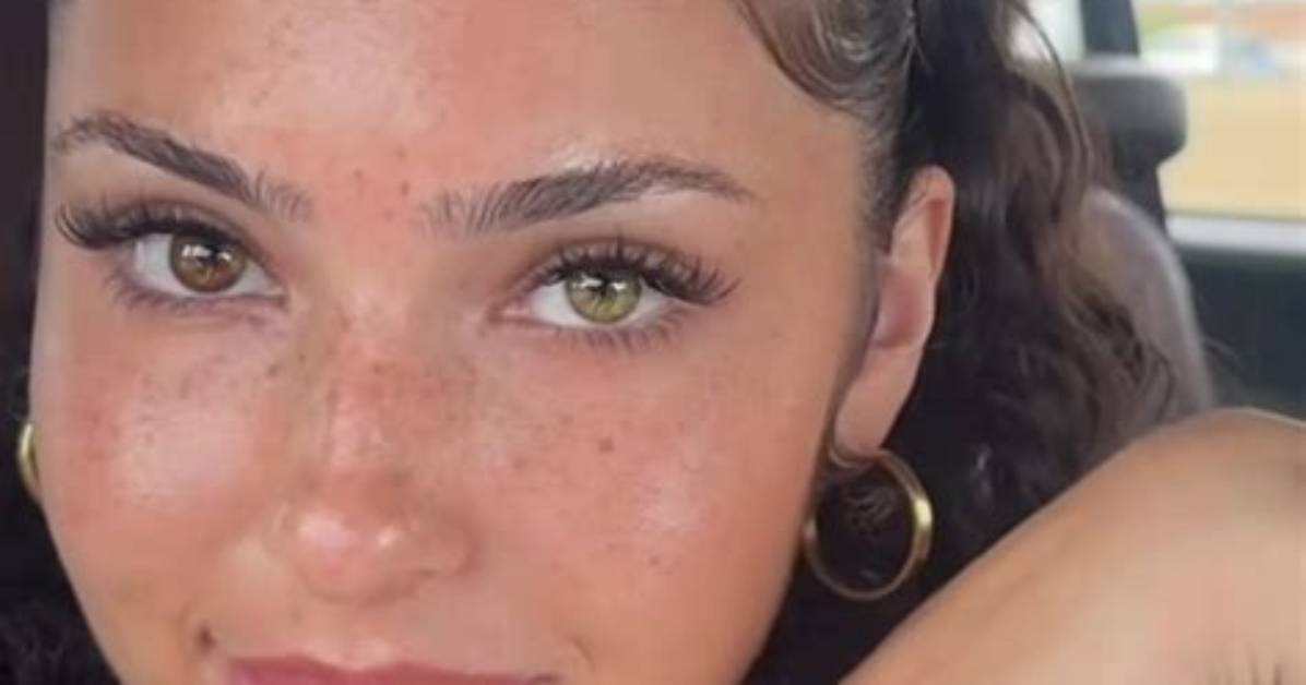 Who Is Tiktok’s @Ashaley. Nucole? Images of Ash Kaash Before Surgery