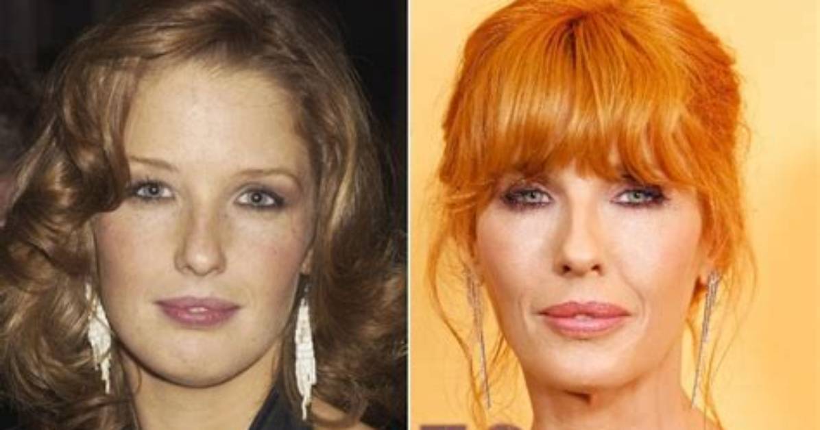 Yellowstone: Did Angela Get Lips Surgery | Before and After