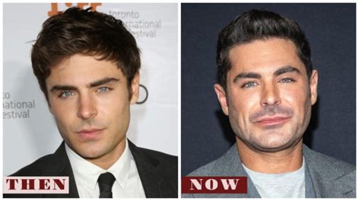 Zac Efron Healing From Surgery After Tearing His ACL E! News Australia