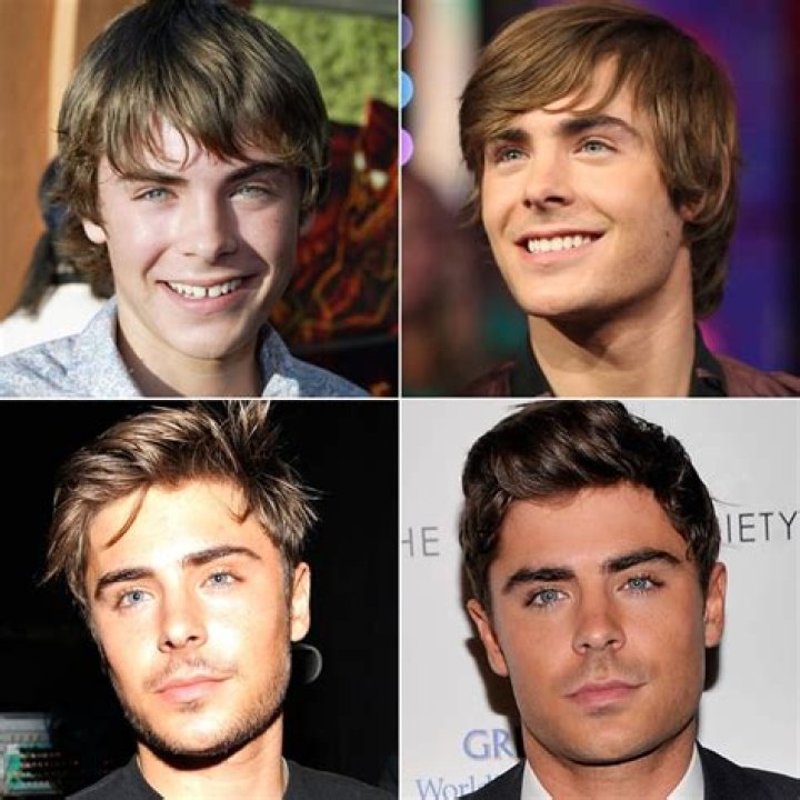 Zac Efron through the years His career evolution in photos Monkey Viral