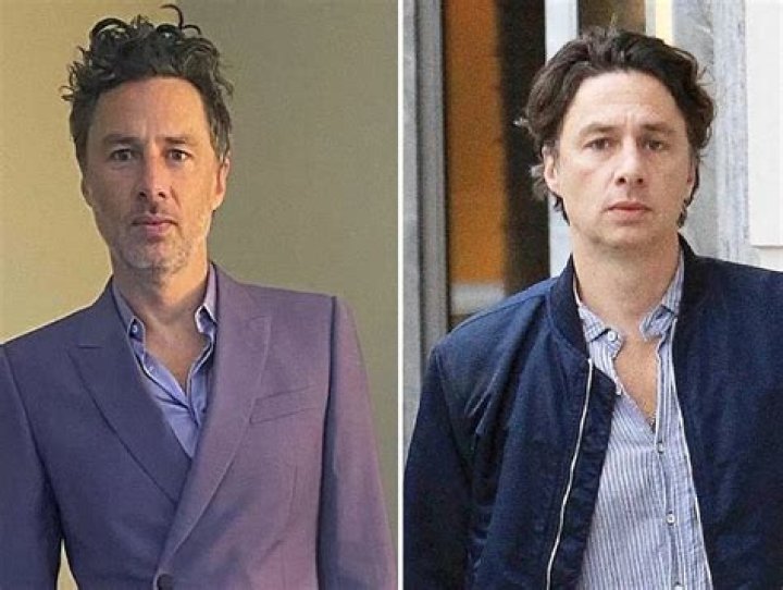 Zach Braff Plastic Surgery Rumors and Facts