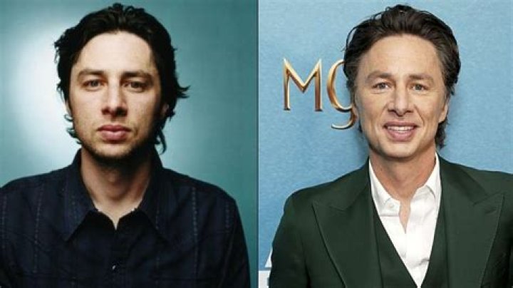 Zach Braff Plastic Surgery Speculations Analyzing the Changes Through